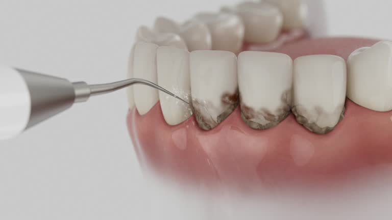 Reliable Wisdom Tooth Removal contractor in Todd County County, SD by Dentist Open Now